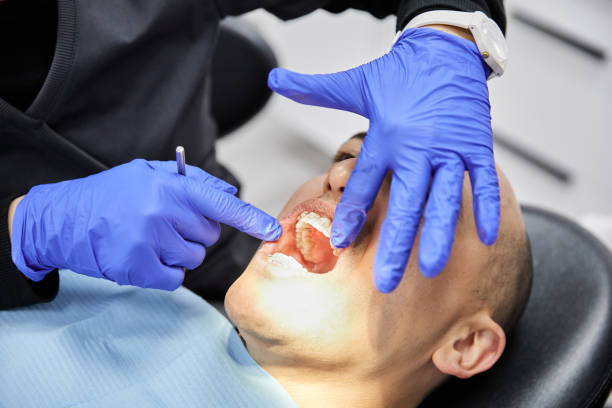 Best Emergency Dental Care for Broken or Chipped Teeth in Butler Beach, FL